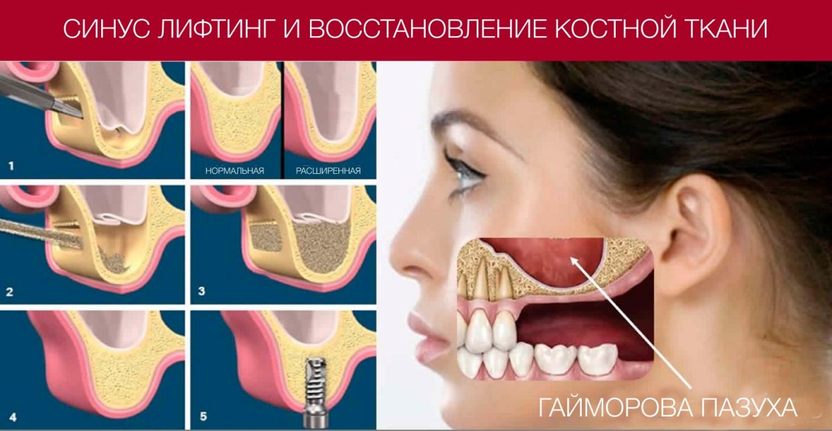 Иллюстрация к публикации